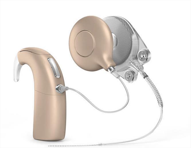 Recent advances in Cochlear implants for hearing